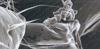Εικόνα 1 : Φωτογραφία από ηλεκτρονικό μικροσκόπιο του άκρου του ποδιού ενός ακάρεως βαρρόα, στην κατάληξη του οποίου διακρίνονται μικροί κόκκοι άχνης ζάχαρης.