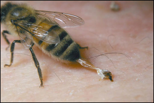 Εικόνα 2: Μηχανισμός κεντρίσματος της μέλισσας(http://beestings.net/how_a_bee_stings.htm)