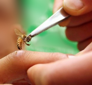 Εικόνα 2: Άμεση χρήση του δηλητηρίου της μέλισσας με απευθείας κέντρισμα